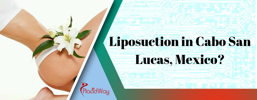 Liposuction in Cabo San Lucas, Mexico